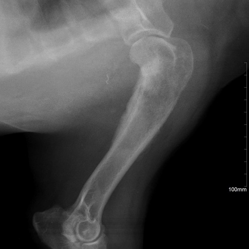 RTG neoplazie kosti pažní - osteosarkom